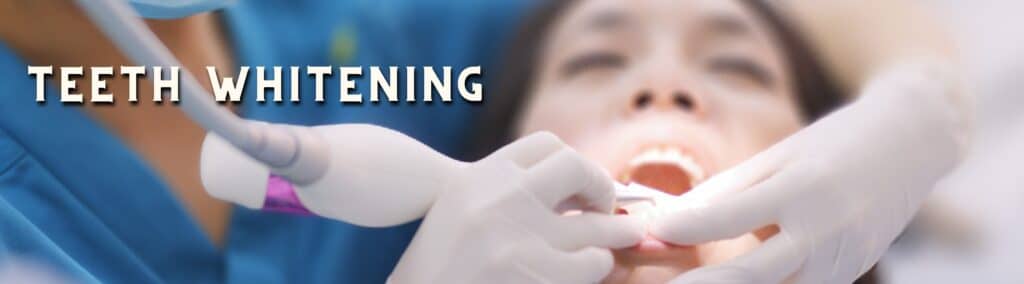 teeth whitening in delhi