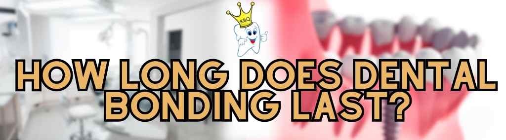 how long does dental bonding last