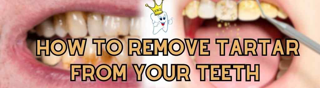 how to remove tartar without a dentist
